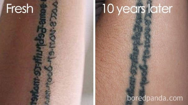 문신 시술 후 변화