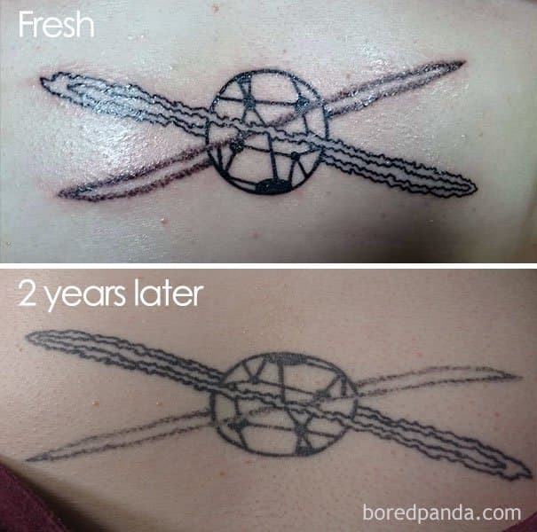 문신 시술 후 변화
