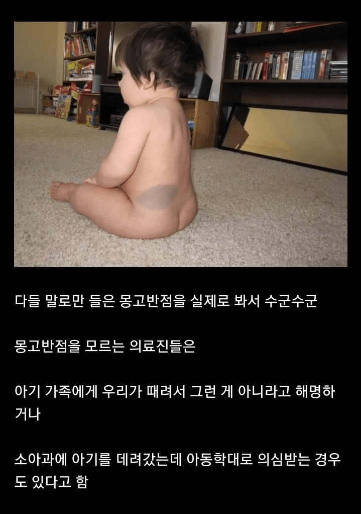 미국 의사들이 동양인 아기보면 경악하는 이유